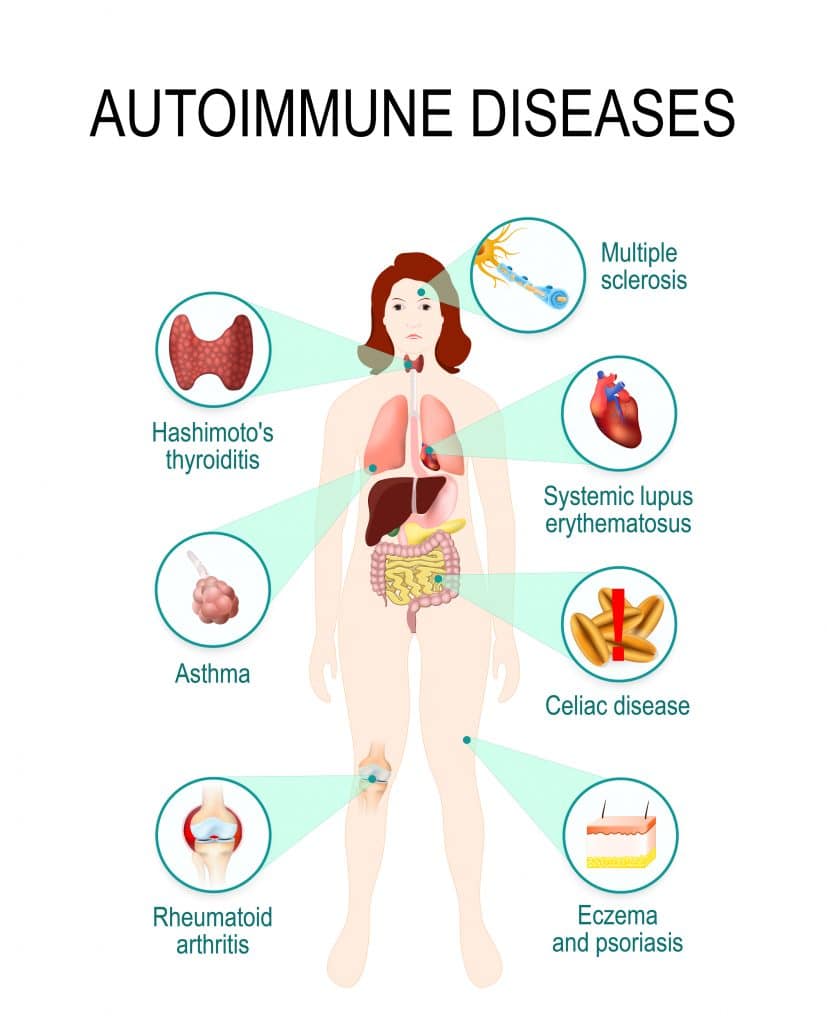 What Causes Autoimmune Conditions