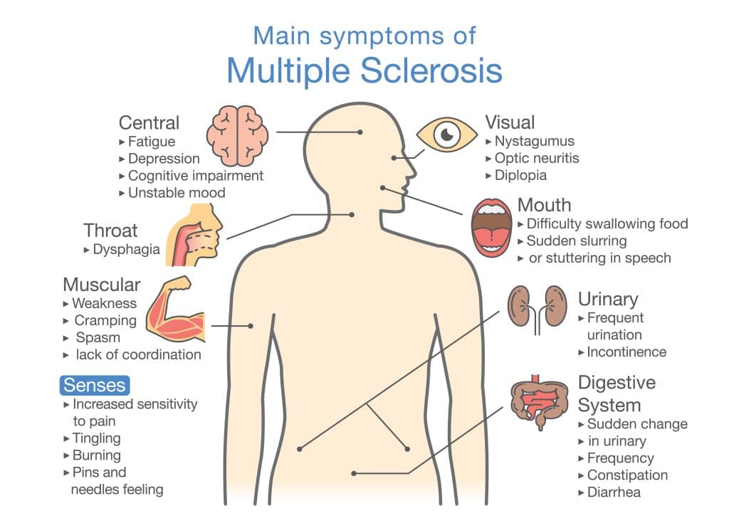 What Causes Multiple Sclerosis