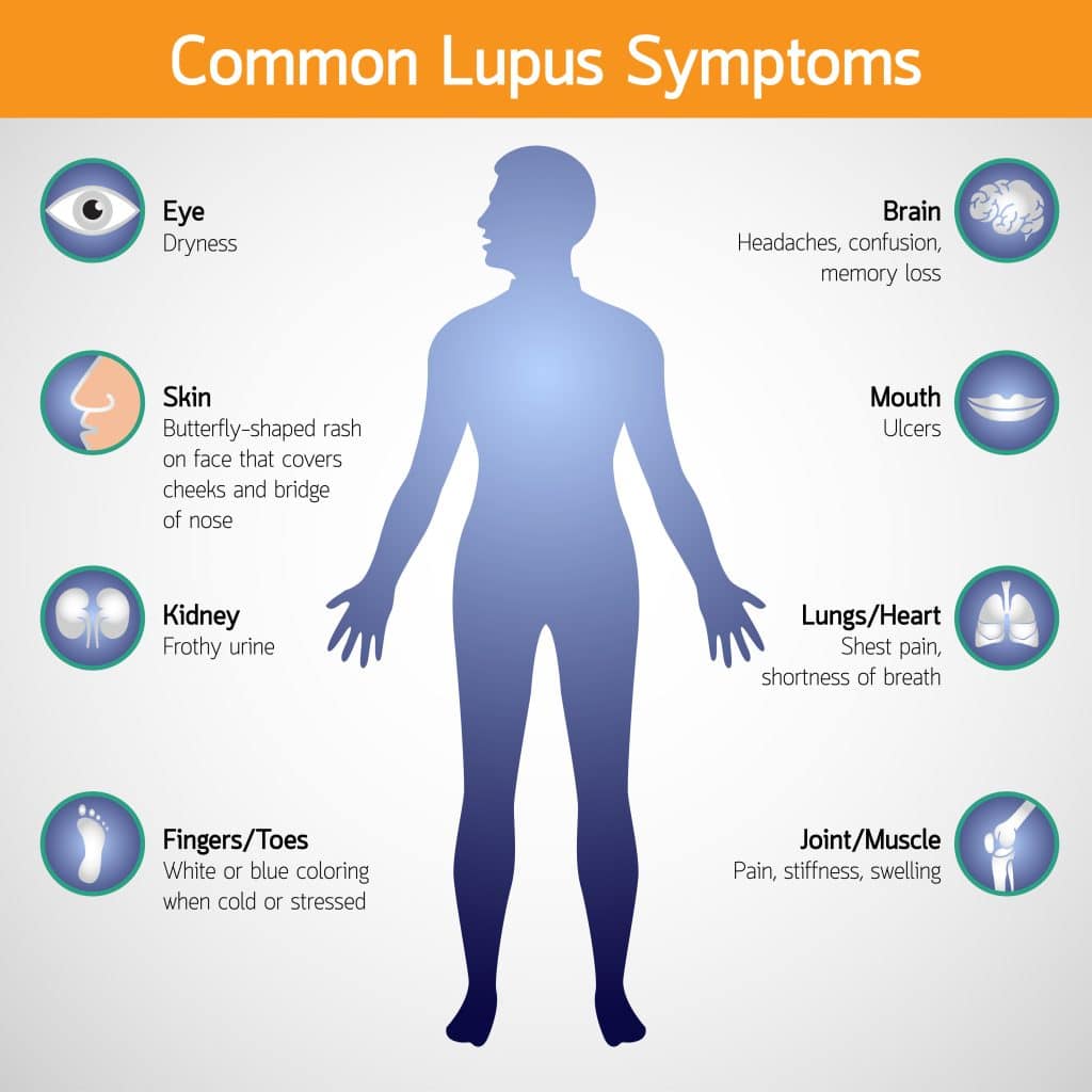 What Causes Lupus