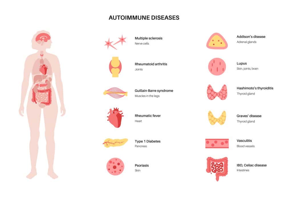 Heavy Metals Cause Autoimmune Conditions