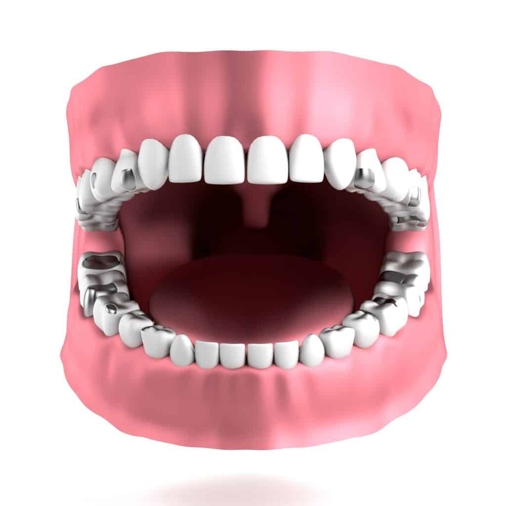 Remove Dental Fillings