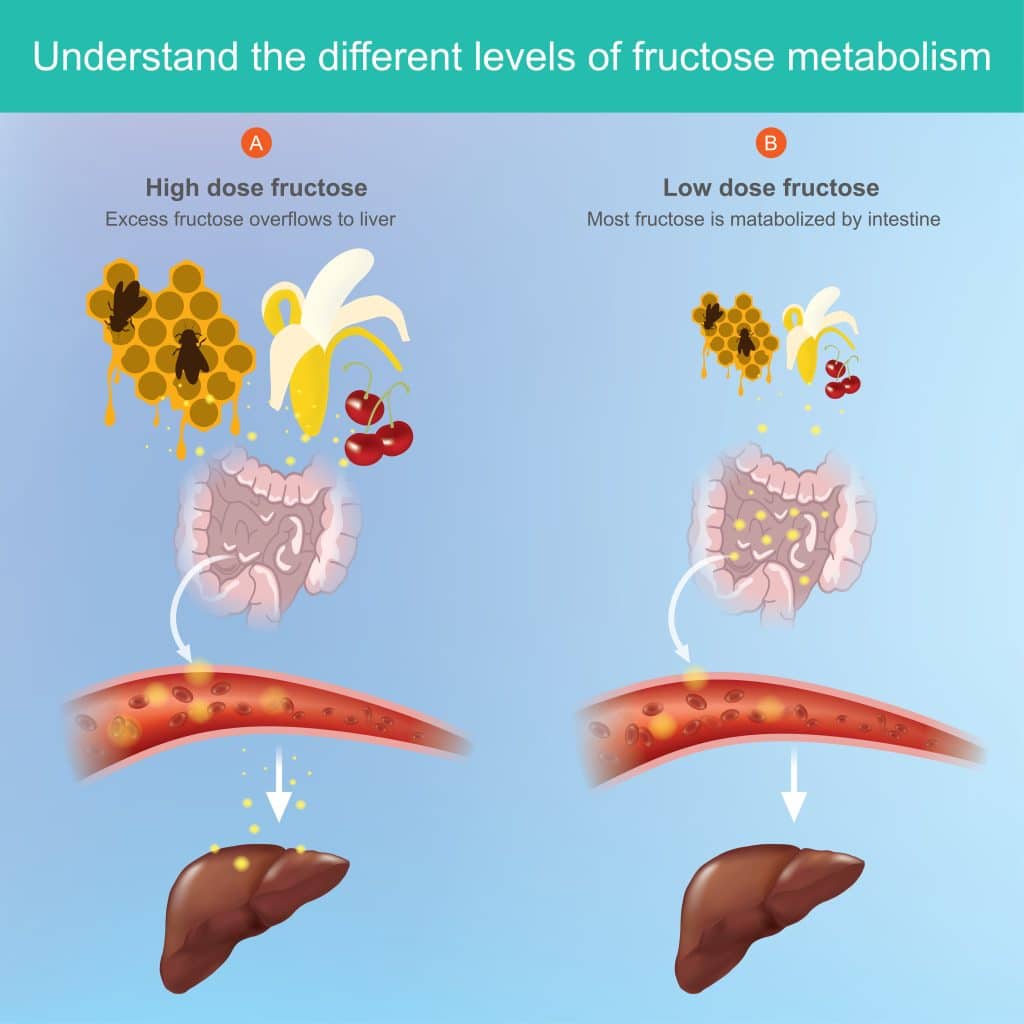 What Causes Fatty Liver Disease - Sugar And High Fructose Corn Syrup