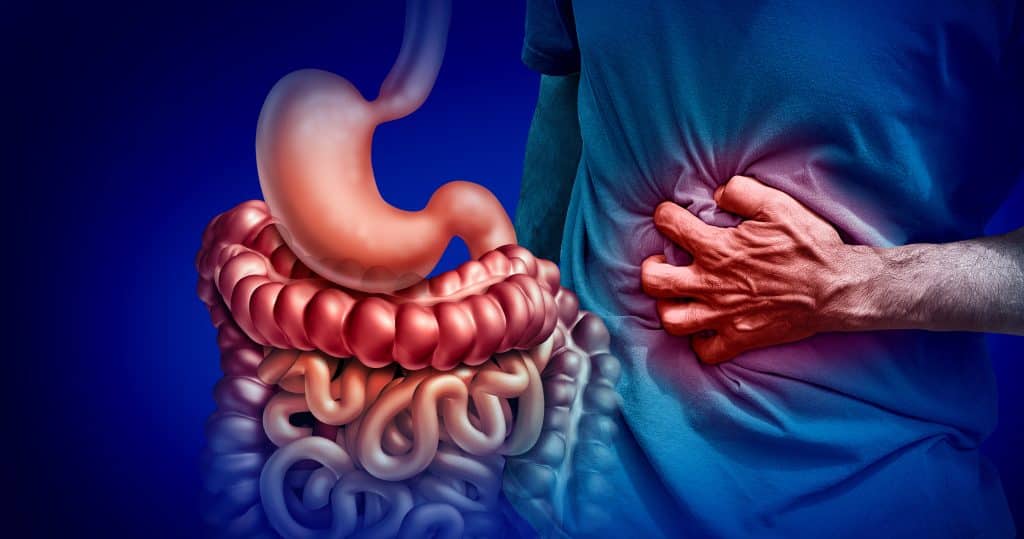 Inflammatory bowel disease (IBD) - Symptoms and causes - Mayo Clinic