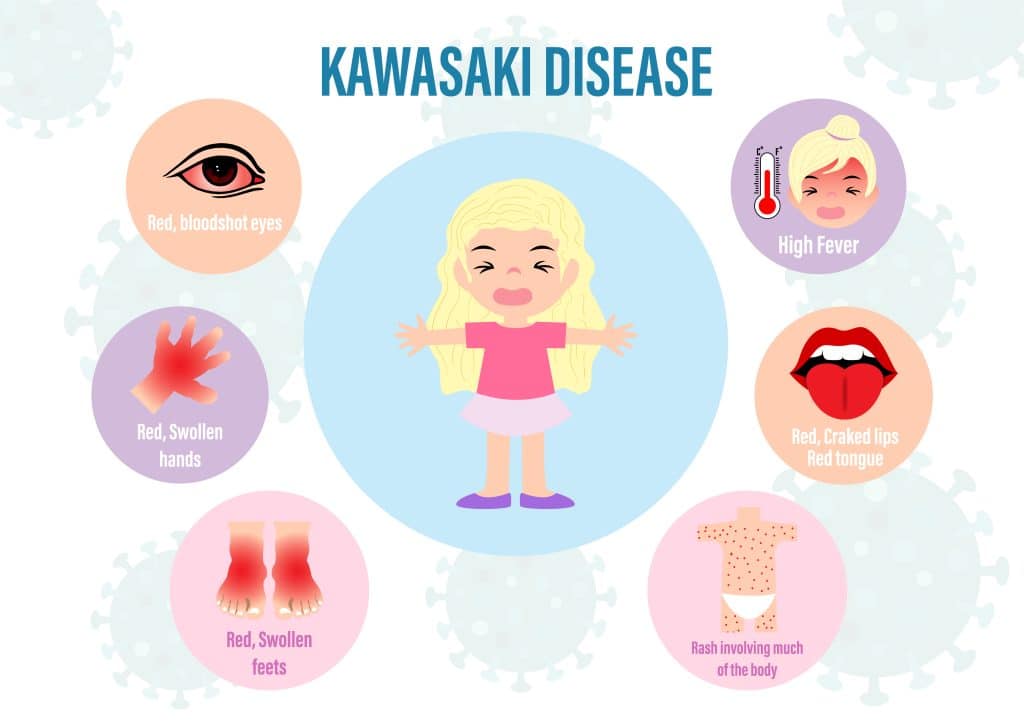 What Causes Kawasaki Disease - Mercury