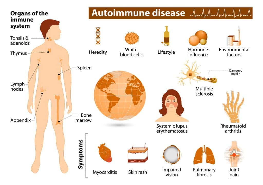 Symptoms of autoimmune disease
