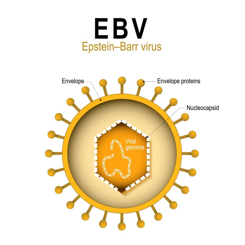 What Causes Autoimmune Disorders - EBV