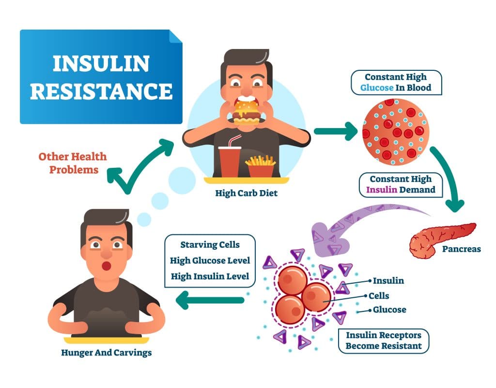 What Causes Weight Gain - Insulin Resistance