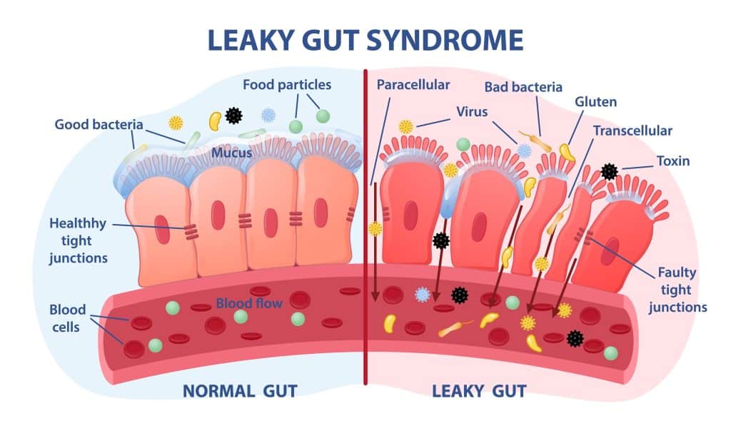 What Causes Thyroid Problems - Microbiome Dysfunction