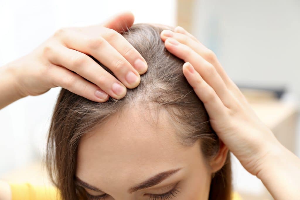 Do I Have An Autoimmune Condition - Loss Of Hair