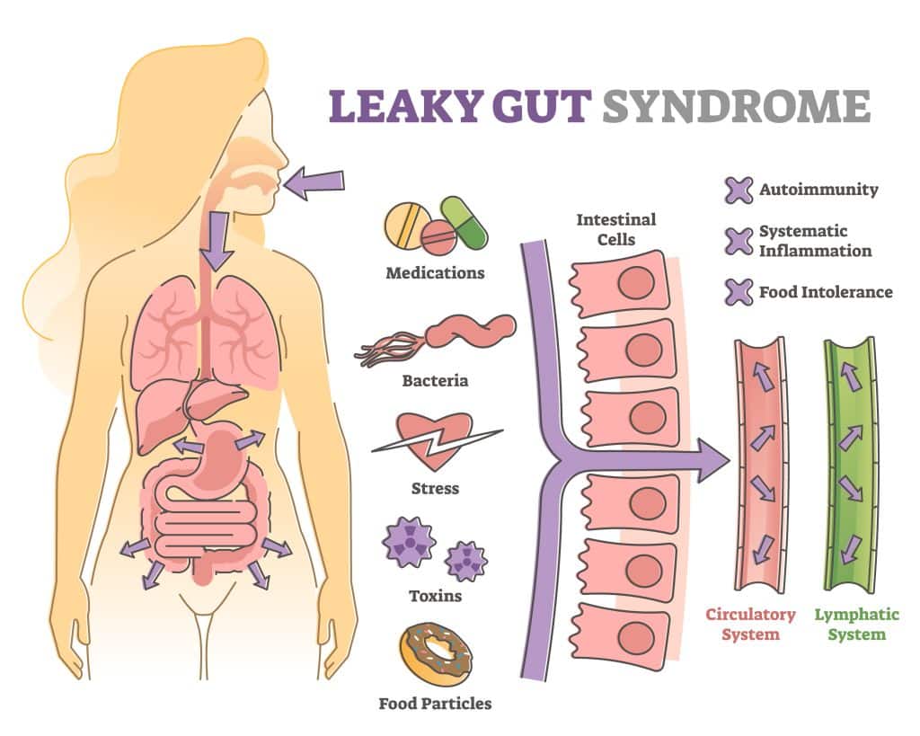 How To Fix Leaky Gut