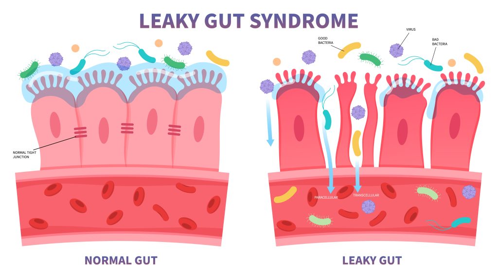 You Are Unknowingly Consuming Toxins - Artificial Sweeteners - Leaky Gut Syndrome
