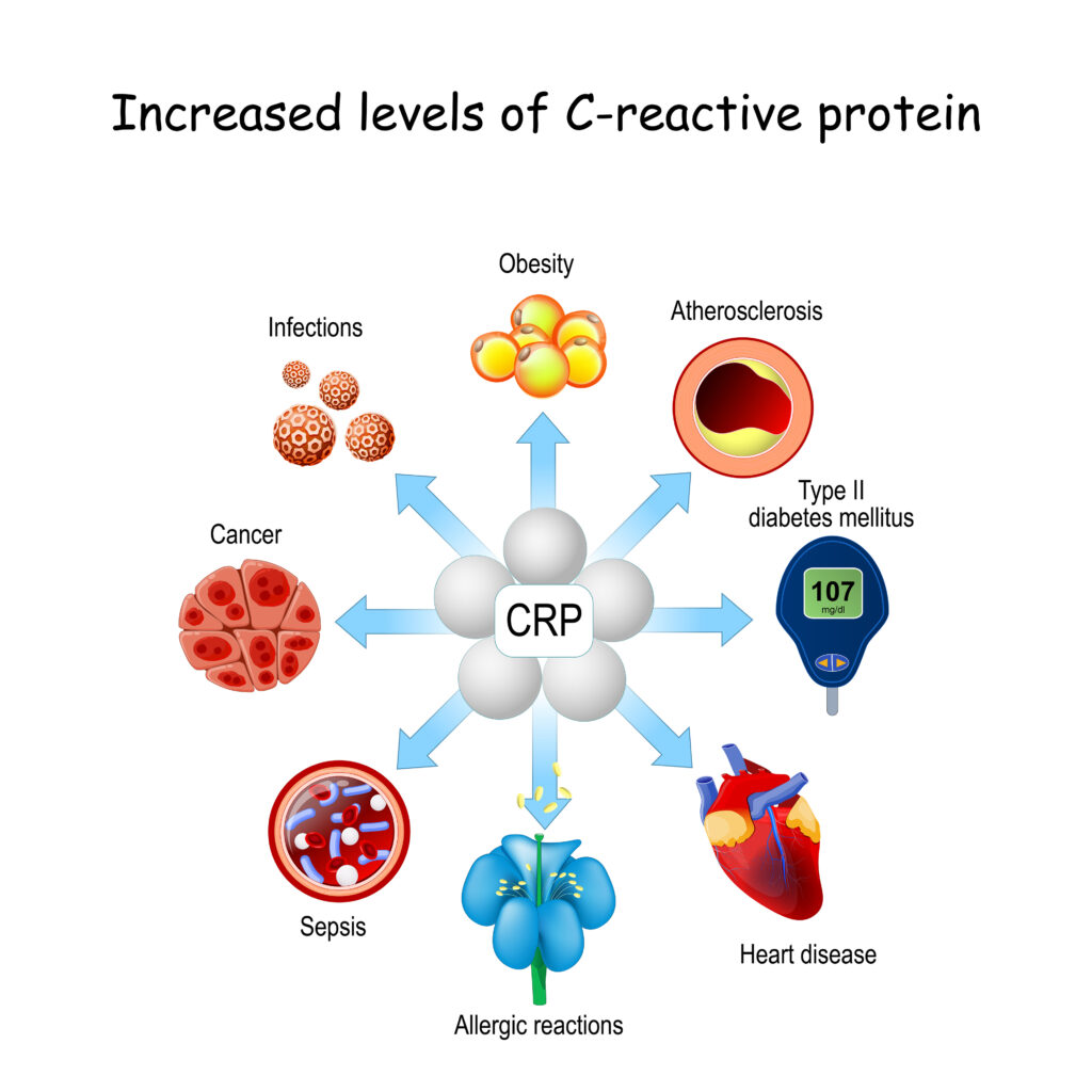 C-reactive protein (CRP) and obesity