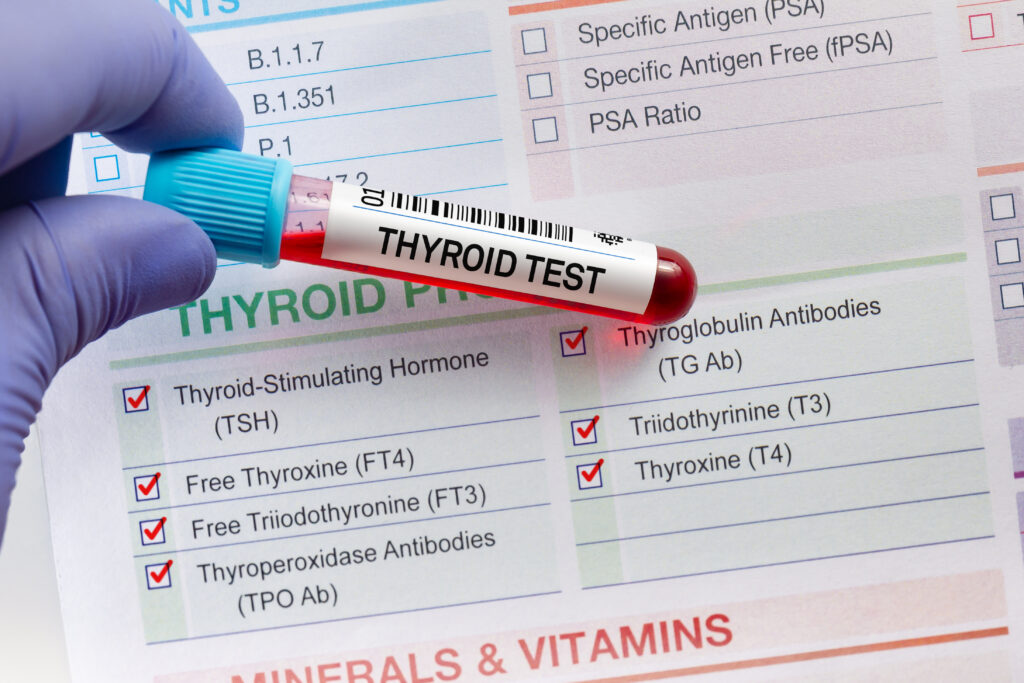 The Increasing Prevalence Of Hypothyroidism - Thyroid Hormone Resistance