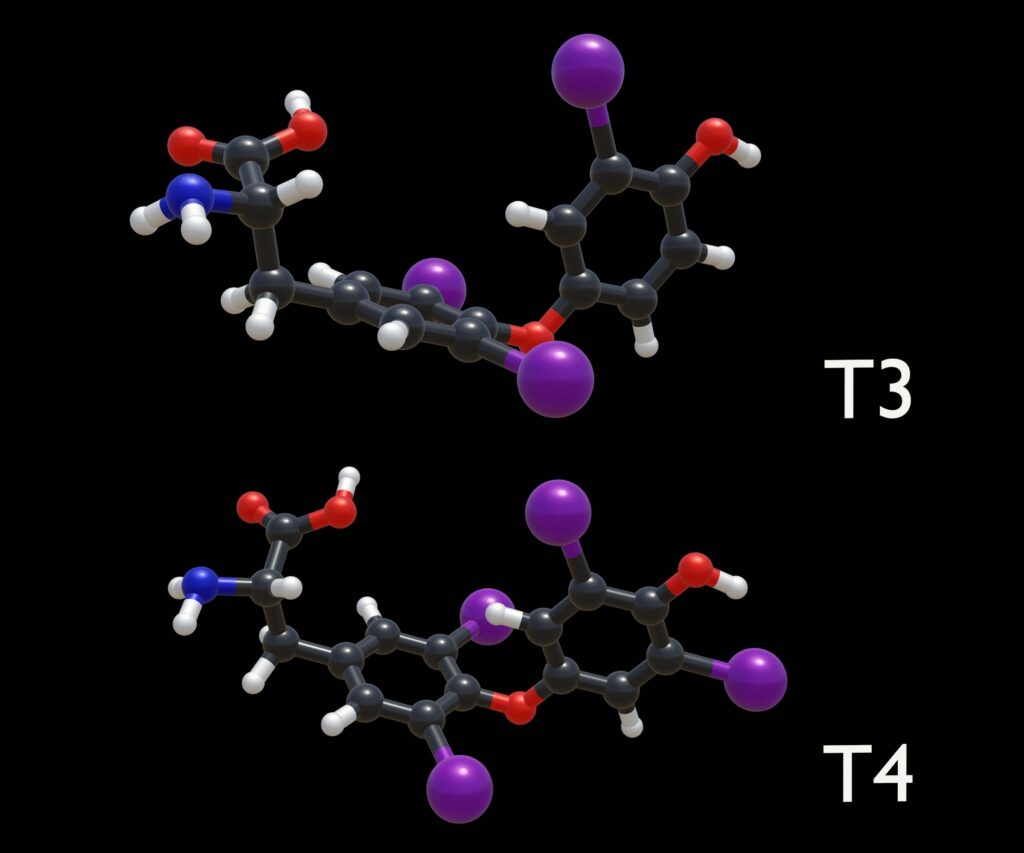 What Causes Thyroid Hormone Resistance