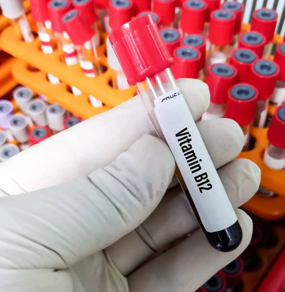 What Causes Pernicious Anemia Pompa Program Masterclass